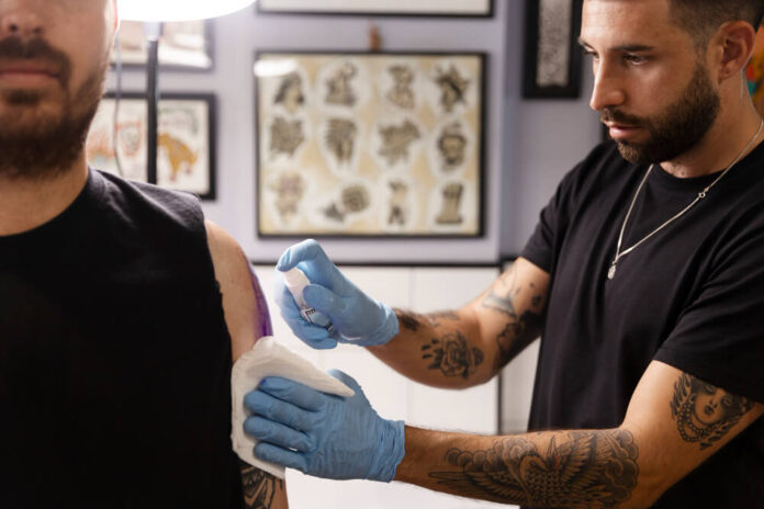 How to Remove a Tattoo and What to Expect From the Process